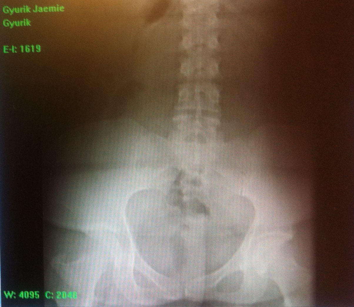 Lower Back & Hip X-ray replacement-parts